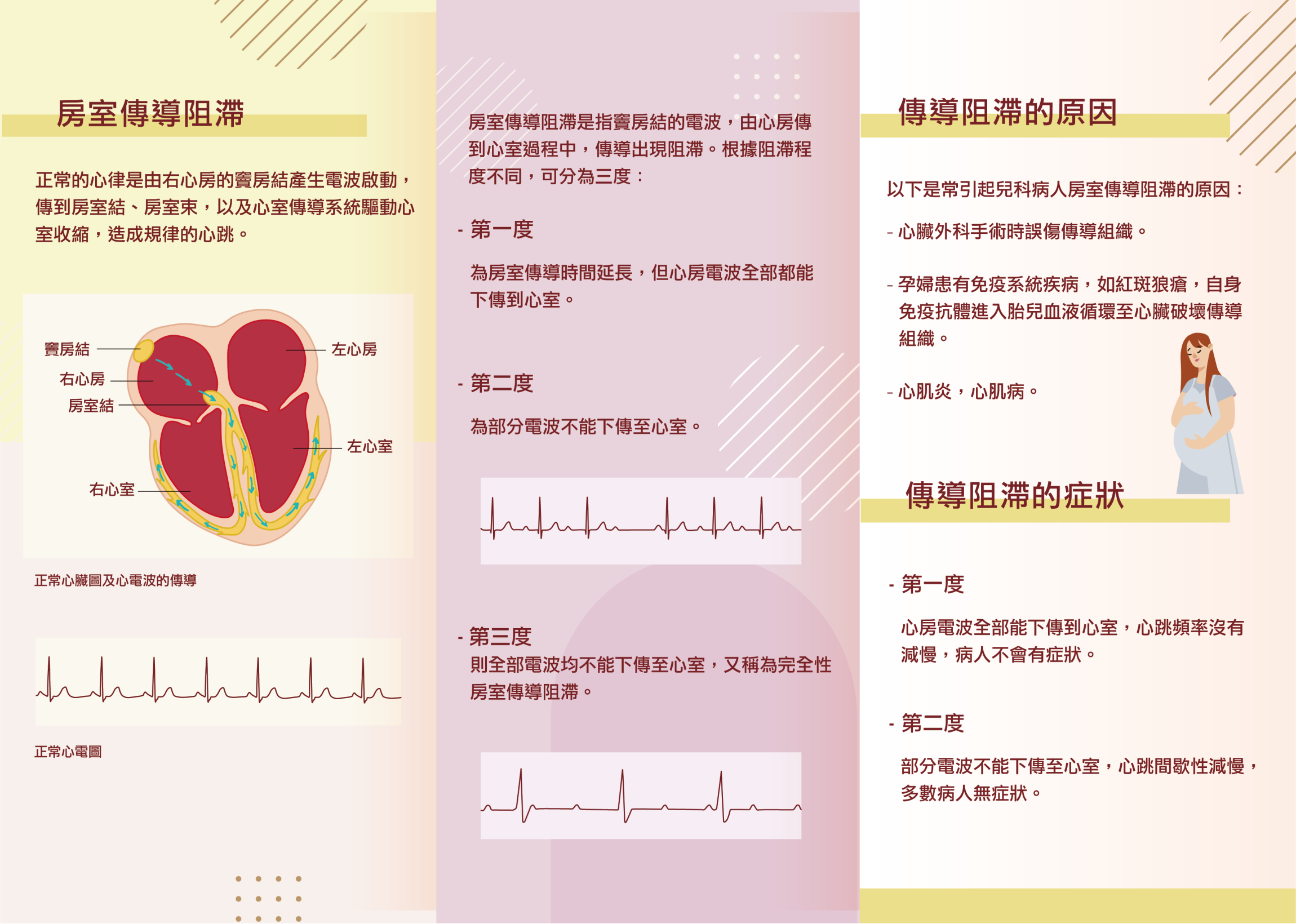 本頁圖片/檔案 - Final_AVB Leaflet-02